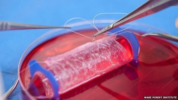 Lab-grown vaginas have been successfully implanted in four women